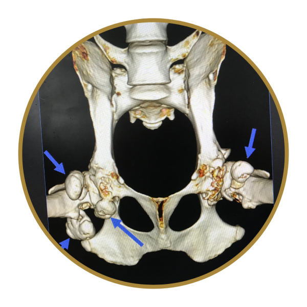 Hip Dysplasia In Dogs Photo 2