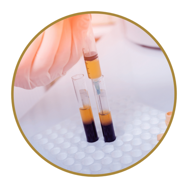 Platelet Rich Plasma Therapy Photo 1